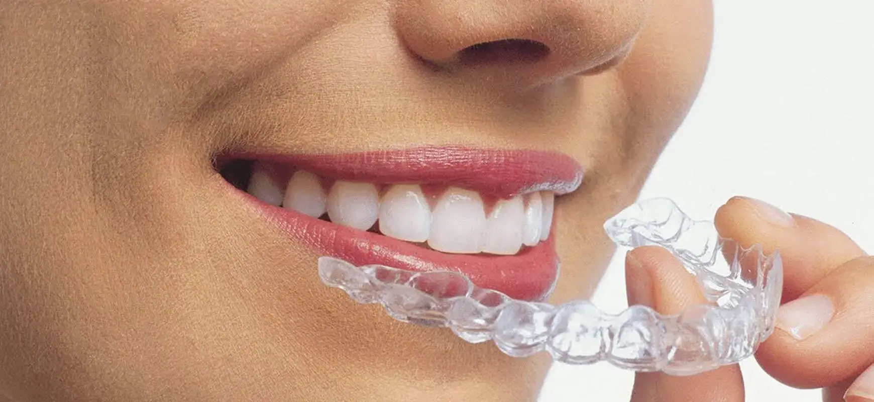 Invisalign ve şeffaf plak tedavisi